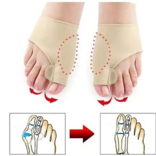 CorrectorFlex™ - Corrector Ortopédico de Juanetes ( 1 Par )